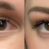 Before and After AnteAge Eye Cream