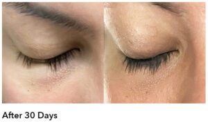 Before and After AnteAGE Lash Serum