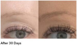 Before and After AnteAGE Lash Serum photo