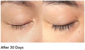 AnteAGE Lash Serum Before and After 