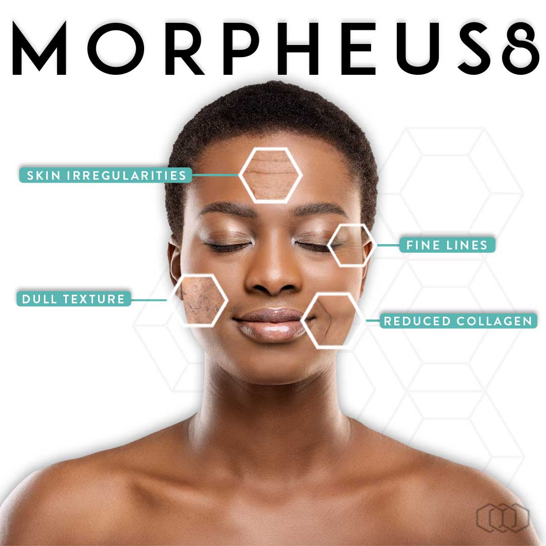 A person with their eyes closed and the words morpheus 8 written on them.