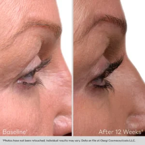 Before and After Lash Serum Obagi