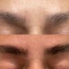 Before and After Eyebrow Boosting Serum - Obagi Nu Cil