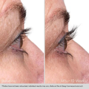 Before and After Obagi Lash Treatment