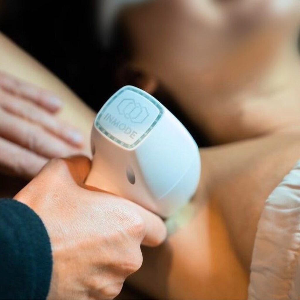 best laser hair removal knoxville tn​